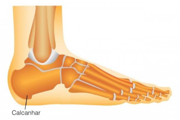 Dor no calcanhar: pode ser fascite plantar. Doctor Feet Podologia